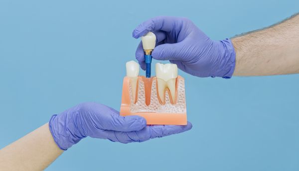 Complete Your Smile With An Implant Crown